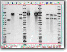 DNA PCR analysis